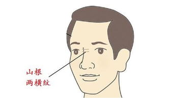 鼻梁生纹预示你40岁前后有一道坎 不同鼻梁纹看你命理几何 