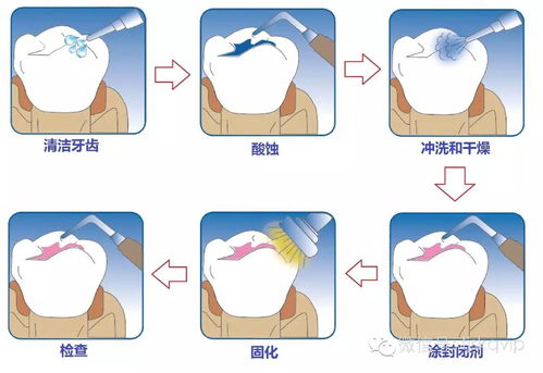 十岁孩子得甲母痣八年了