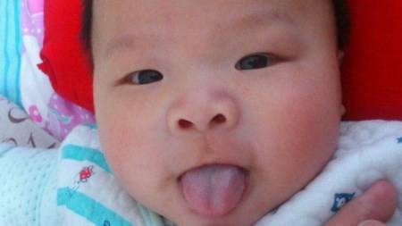 宝宝无意中吐舌头吓到妈妈 舌头不是正常的红色 