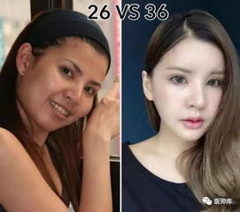 丑女花费700万整容40次,整容后变女神,如今爱情事业双丰收