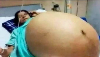 39岁产妇意外怀5胞胎, 确认孩子性别, 乡里乡亲沸腾了