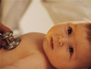 新生婴儿为何会黄疸高,新生儿黄疸高是怎么回事