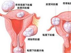 孕妇尿道感染什么症状
