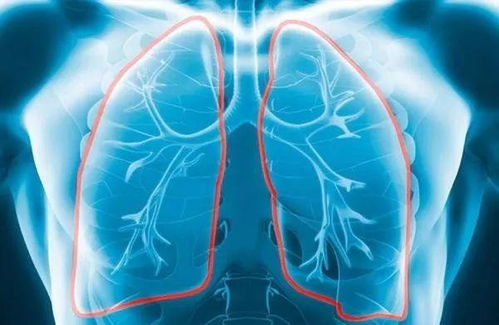 研究人员发现新的分子靶点可以治疗特发性肺纤维化