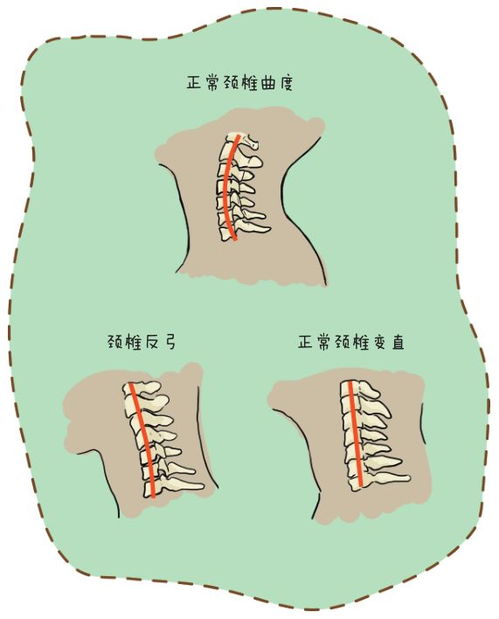 颈椎痛脖子疼图片卡通 搜狗图片搜索