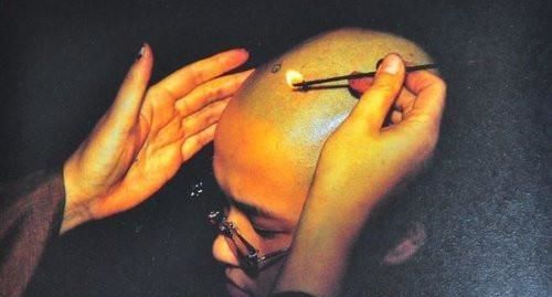 和尚头顶的疤点是什么 为什么印度的僧人没人点疤