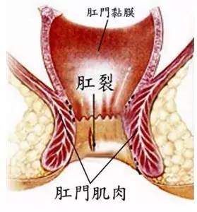 别怪我没提醒你们,拉粑粑别再玩手机了,否则.... 