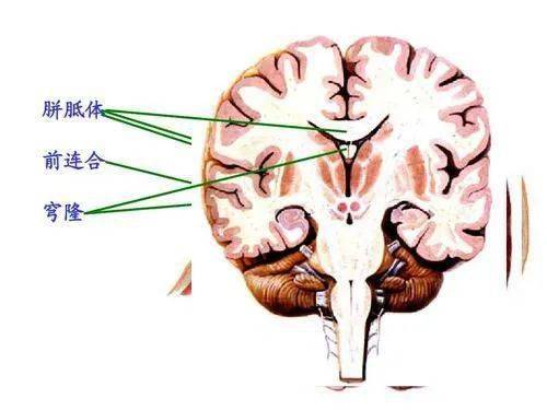 大脑里竟然长了只 蝴蝶 ,这到底是什么病