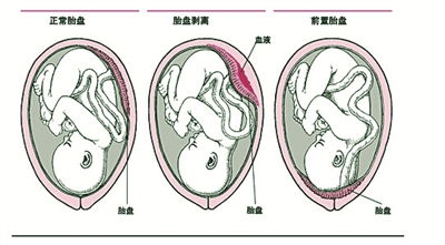 胎盘素的作用 胎盘素的功效与作用