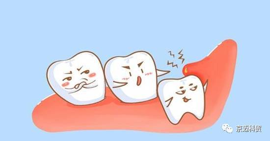 牙疼不是病 疼起来要人命 红瑞小贴士告诉你智齿到底能不能拔