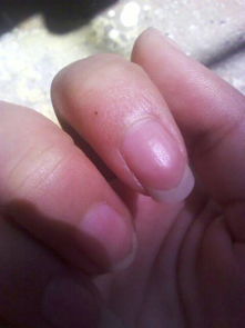 我的右手食指后天长了颗痣,什么意思 