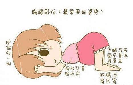 胎位不正需要注意什么