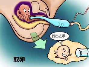 泰国宝贝试管婴儿(泰国试管婴儿流程)