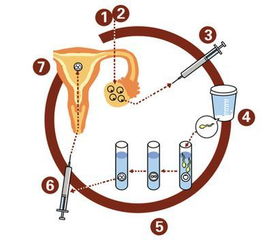 取卵多少颗为正常 影响取卵数的因素是什么