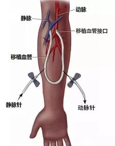 网络路演报名 超声手术 动脉保护 新防霾口罩