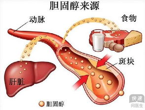 胆固醇高的危害？胆固醇过高有什么危害