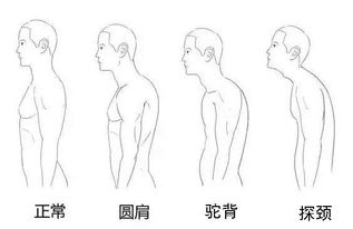 驾驶座椅最重要 不正确的开车姿势很可能会要了命