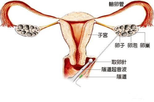 解冻自由 女孩们清醒一点