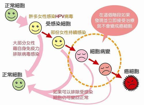 科普 HPV分哪几类 感染后又应如何处理