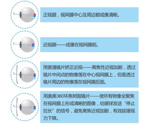 奥美360 环焦镜片,保护孩子的清晰视界