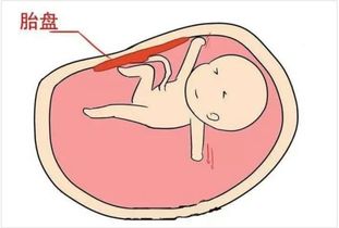 过完年就要孩子了,要不要把胎盘存储起来呢 需要查阅那些资料