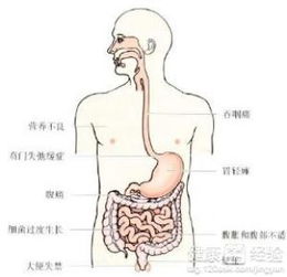 肠梗阻非手术治疗方法