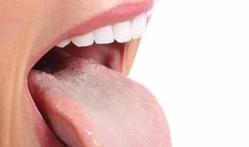 通过舌头能看出疾病 舌头没有这些表现,说明疾病可能离你很远