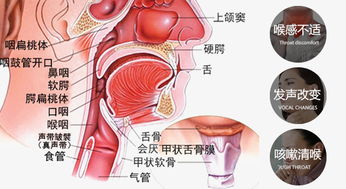 嗓子难受,这是咽喉炎来了