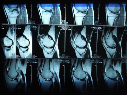 为何很多医生不建议做核磁共振检测 或许很多人都误会了,了解下