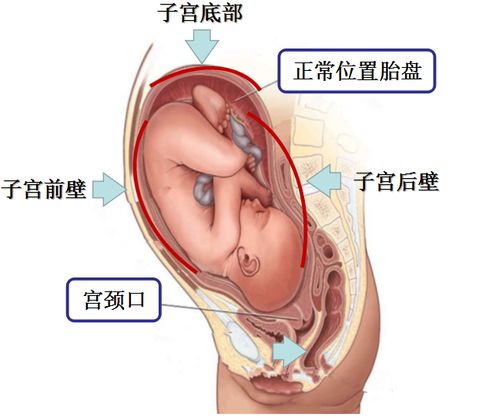 母体下面图片