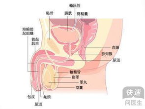 睾丸炎致男性不育