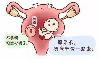 对于女性子宫肌瘤知多少