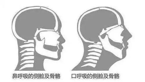 跑步时呼吸是用鼻子还是嘴 哪种方式更合理