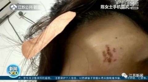 女子想洗掉额头纹身,店主竟喊来不会的老婆,视频边教边操作