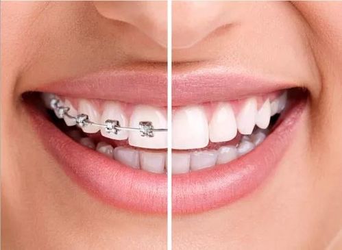 这篇文章告诉你牙套脸该如何防治