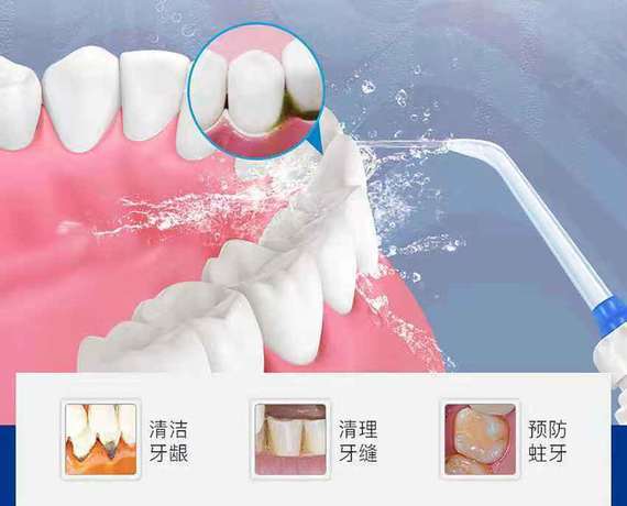 最全珍藏版 口腔科 治疗后医嘱 建议收藏