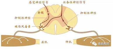 遇到这种 破事 应该怎么办 关于预防破伤风的那些事 