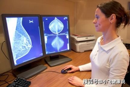 什么人应该定期做乳腺钼靶检查,钼靶的报告应该如何解读呢