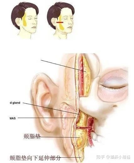 可以通过哪些整容方法改变脸型 