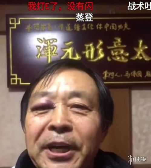 69歲的老童痣是什么意思？