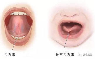 孩子发音不清楚,该如何纠正