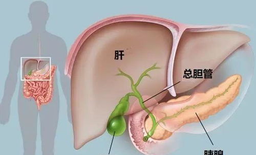 胆结石的 黑手 抓住了,不戒掉这四种行为,会对胆囊越来越不利