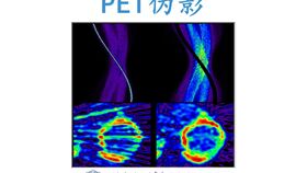 探索近年来医学成像技术红外的应用和发展