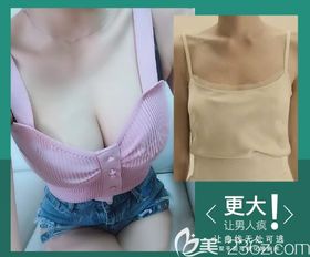 乳房一大一小是怎么回事