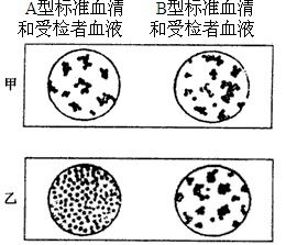 血型鉴定实验中.将受血者血液与标准血清分别混合后.在显微镜下观察.现有两位受检查的血型鉴定结果.如图所示 1 问甲.乙二人分别属于何种血型 2 甲可接受何种血型的血液 