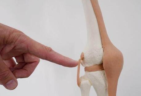 为什么女性易得膝关节炎 这三大原因或是重点
