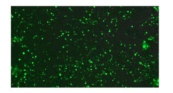 什么是绿色荧光蛋白质(gfp)？