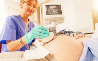 整个孕期,孕妈妈要做多少次产前超声检查 