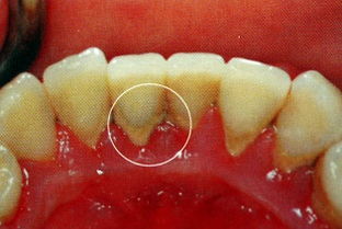 狗狗牙结石宠物店洗牙多少钱一次