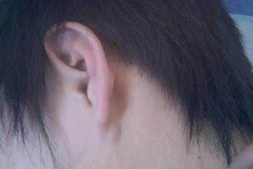耳朵后面长出硬包 专家提醒 可能预示着4种病,男女都别忽视